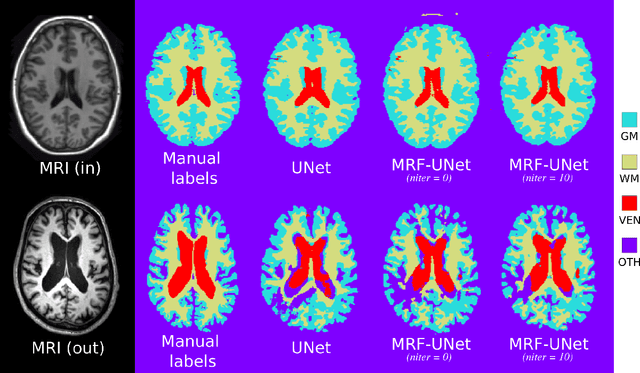 Figure 2 for An MRF-UNet Product of Experts for Image Segmentation