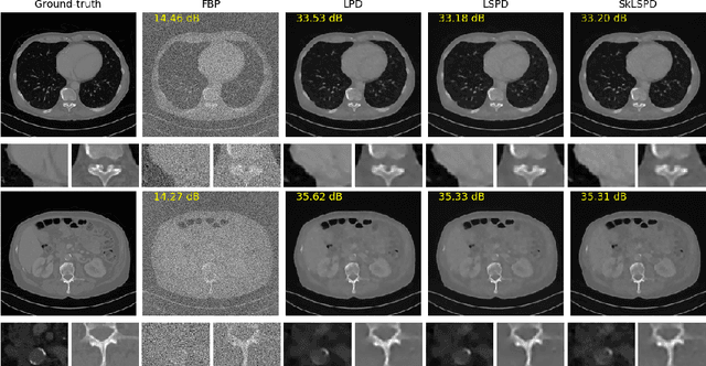 Figure 2 for Accelerating Deep Unrolling Networks via Dimensionality Reduction