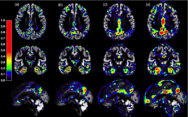 Figure 1 for Yet Another ADNI Machine Learning Paper? Paving The Way Towards Fully-reproducible Research on Classification of Alzheimer's Disease