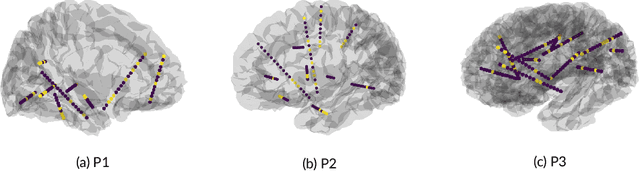 Figure 2 for Synthesizing Speech from Intracranial Depth Electrodes using an Encoder-Decoder Framework