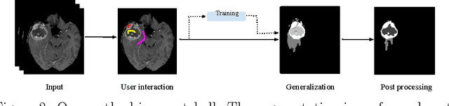Figure 3 for Within-Brain Classification for Brain Tumor Segmentation