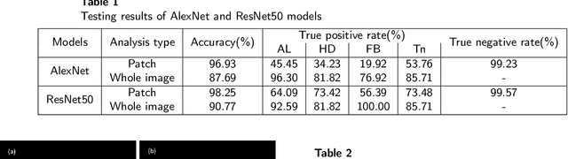 Figure 2 for Parasitic Egg Detection and Classification in Low-cost Microscopic Images using Transfer Learning
