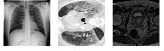 Figure 2 for M3d-CAM: A PyTorch library to generate 3D data attention maps for medical deep learning