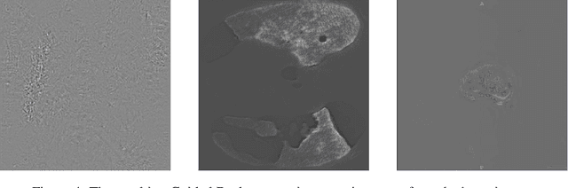 Figure 4 for M3d-CAM: A PyTorch library to generate 3D data attention maps for medical deep learning