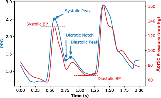 Figure 1 for A Deep Learning Approach to Predict Blood Pressure from PPG Signals