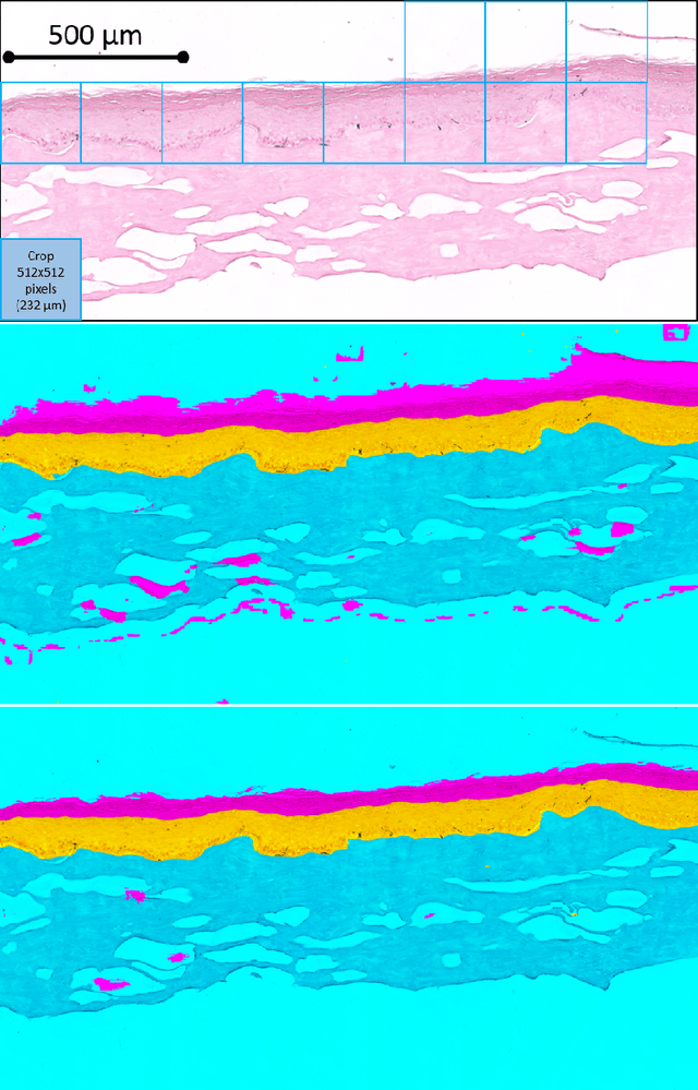 Figure 3 for Dealing with Topological Information within a Fully Convolutional Neural Network