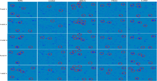 Figure 3 for OncoNetExplainer: Explainable Predictions of Cancer Types Based on Gene Expression Data