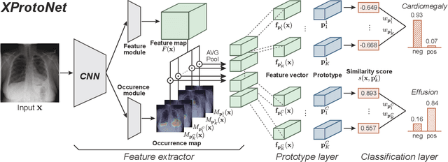 Figure 2 for XProtoNet: Diagnosis in Chest Radiography with Global and Local Explanations