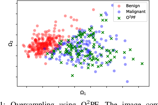 Figure 1 for $\text{O}^2$PF: Oversampling via Optimum-Path Forest for Breast Cancer Detection