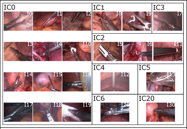 Figure 1 for Comparative Validation of Machine Learning Algorithms for Surgical Workflow and Skill Analysis with the HeiChole Benchmark