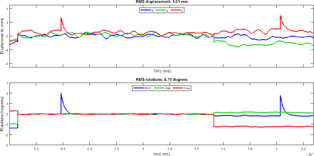 Figure 1 for Which K-Space Sampling Schemes is good for Motion Artifact Detection in Magnetic Resonance Imaging?