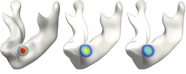 Figure 1 for Unified Heat Kernel Regression for Diffusion, Kernel Smoothing and Wavelets on Manifolds and Its Application to Mandible Growth Modeling in CT Images