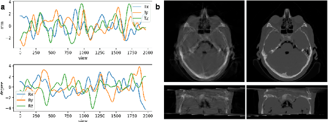Figure 3 for Motion Correction via Locally Linear Embedding for Helical Photon-counting CT