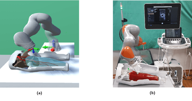 Figure 3 for Robotized Ultrasound Imaging of the Peripheral Arteries -- a Phantom Study