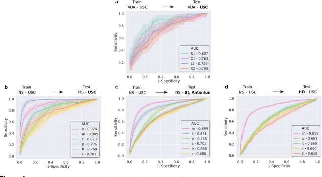 Figure 4 for Quantification of Robotic Surgeries with Vision-Based Deep Learning