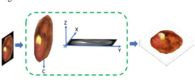 Figure 2 for Challenges of 3D Surface Reconstruction in Capsule Endoscopy