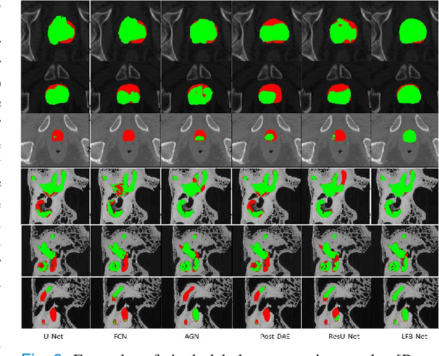 Figure 3 for Learning With Context Feedback Loop for Robust Medical Image Segmentation