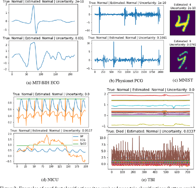 Figure 3 for Bayesian LSTMs in medicine