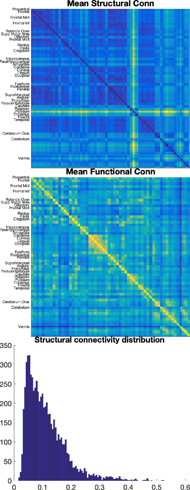 Figure 2 for Single-participant structural connectivity matrices lead to greater accuracy in classification of participants than function in autism in MRI