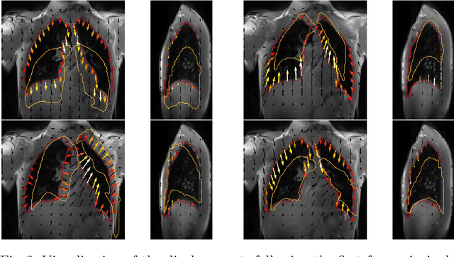Figure 2 for Exploring Deep Registration Latent Spaces