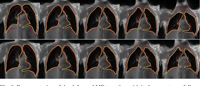 Figure 3 for Exploring Deep Registration Latent Spaces