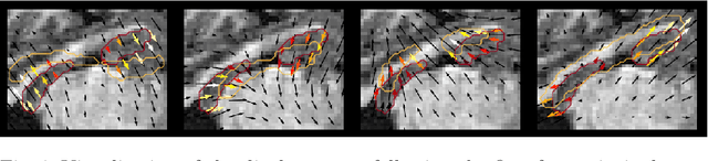 Figure 4 for Exploring Deep Registration Latent Spaces