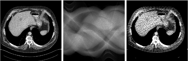 Figure 2 for Deep Bayesian Inversion