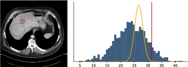 Figure 4 for Deep Bayesian Inversion