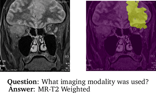 Figure 1 for MMBERT: Multimodal BERT Pretraining for Improved Medical VQA