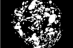 Figure 4 for Detection of Diabetic Anomalies in Retinal Images using Morphological Cascading Decision Tree