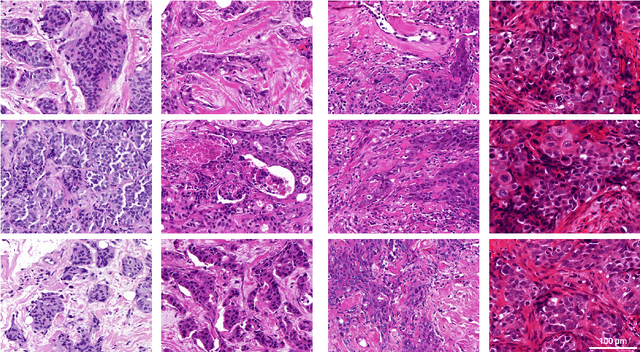 Figure 2 for Recommendations on test datasets for evaluating AI solutions in pathology