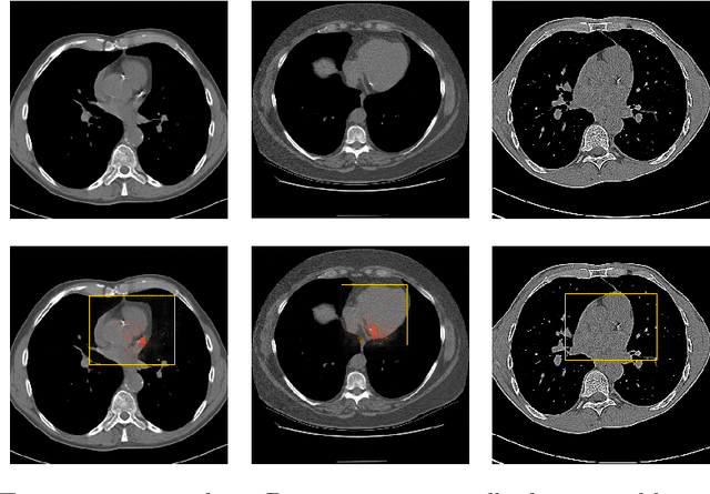 Figure 3 for Direct and Real-Time Cardiovascular Risk Prediction