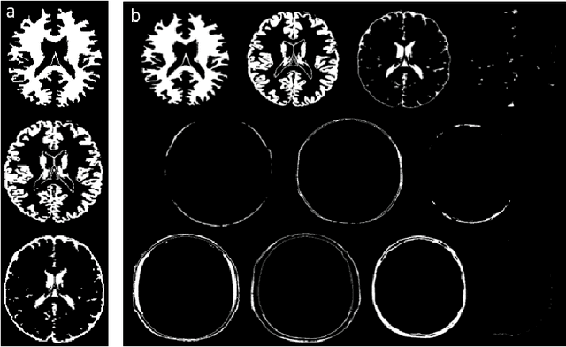 Figure 2 for A Fast MR Fingerprinting Simulator for Direct Error Estimation and Sequence Optimization