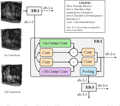Figure 1 for 3D-OOCS: Learning Prostate Segmentation with Inductive Bias
