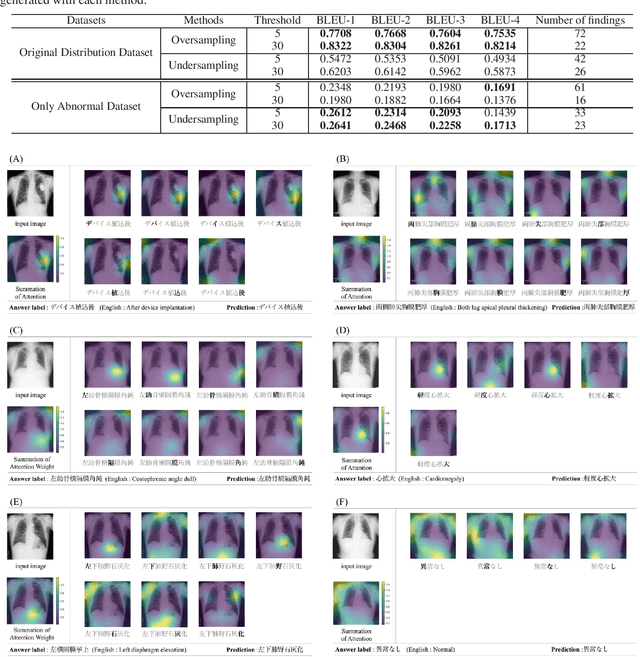 Figure 4 for Character-level Japanese Text Generation with Attention Mechanism for Chest Radiography Diagnosis