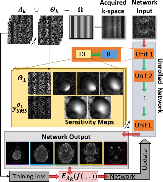 Figure 1 for Improved Simultaneous Multi-Slice Functional MRI Using Self-supervised Deep Learning