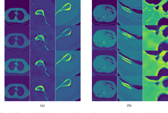 Figure 3 for Learning to Scan: A Deep Reinforcement Learning Approach for Personalized Scanning in CT Imaging