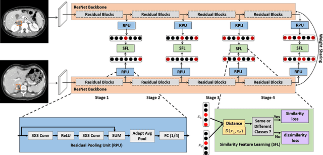 Figure 2 for Deep Multi-Scale Resemblance Network for the Sub-class Differentiation of Adrenal Masses on Computed Tomography Images