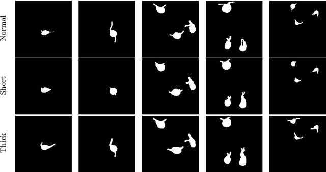 Figure 2 for AOSLO-net: A deep learning-based method for automatic segmentation of retinal microaneurysms from adaptive optics scanning laser ophthalmoscope images