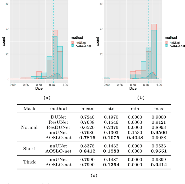 Figure 3 for AOSLO-net: A deep learning-based method for automatic segmentation of retinal microaneurysms from adaptive optics scanning laser ophthalmoscope images