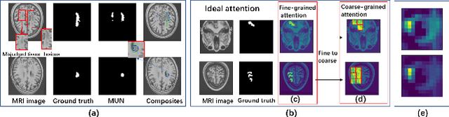 Figure 1 for TC-Net: Triple Context Network for Automated Stroke Lesion Segmentation