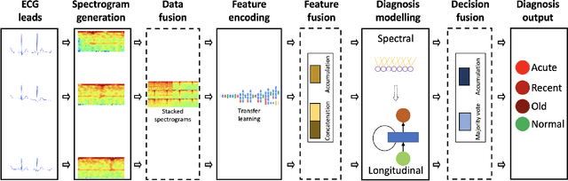 Figure 1 for DeepMI: Deep Multi-lead ECG Fusion for Identifying Myocardial Infarction and its Occurrence-time