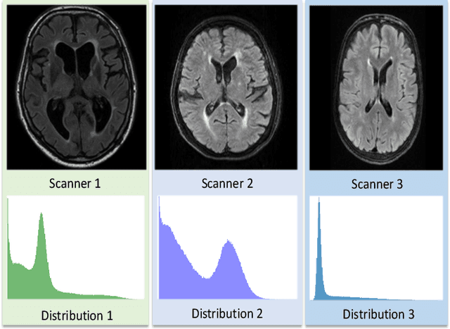 Figure 1 for e-UDA: Efficient Unsupervised Domain Adaptation for Cross-Site Medical Image Segmentation