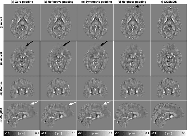 Figure 4 for Improved Padding in CNNs for Quantitative Susceptibility Mapping