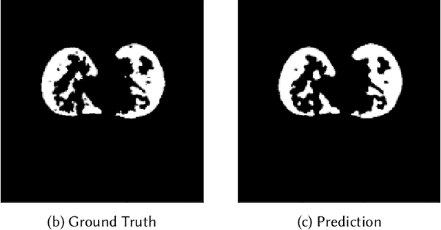 Figure 4 for Evaluating Transferability for Covid 3D Localization Using CT SARS-CoV-2 segmentation models