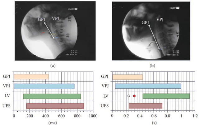 Figure 3 for A multimodal approach for Parkinson disease analysis