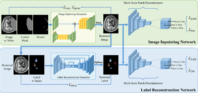 Figure 2 for TBI-GAN: An Adversarial Learning Approach for Data Synthesis on Traumatic Brain Segmentation