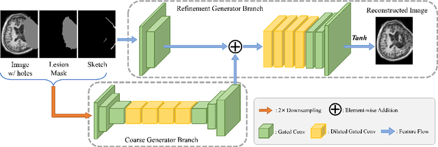 Figure 3 for TBI-GAN: An Adversarial Learning Approach for Data Synthesis on Traumatic Brain Segmentation