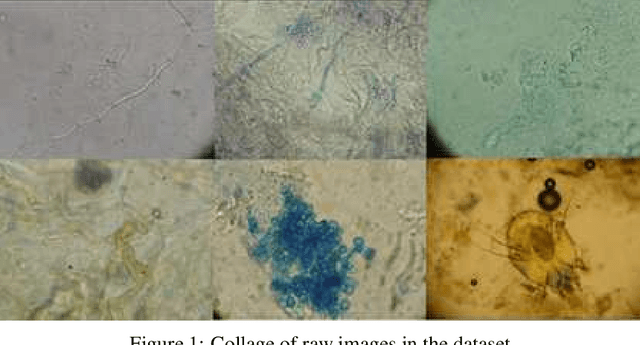 Figure 1 for DeFungi: Direct Mycological Examination of Microscopic Fungi Images