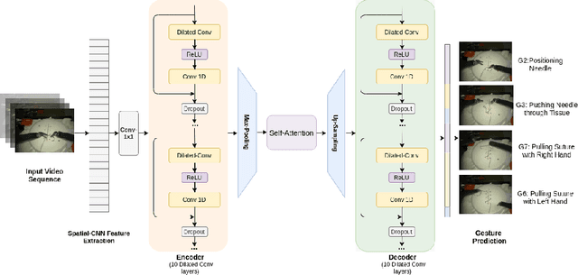 Figure 1 for Symmetric Dilated Convolution for Surgical Gesture Recognition